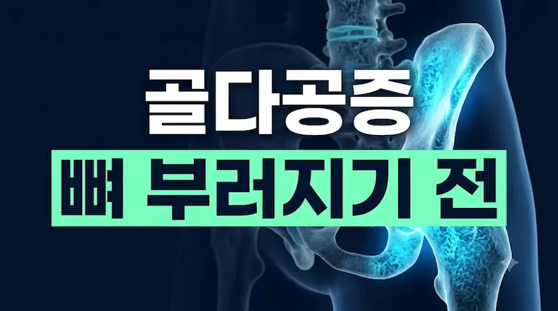 EBS 명의 골다공증 탈출법 및 골절 예방 대표 썸네일