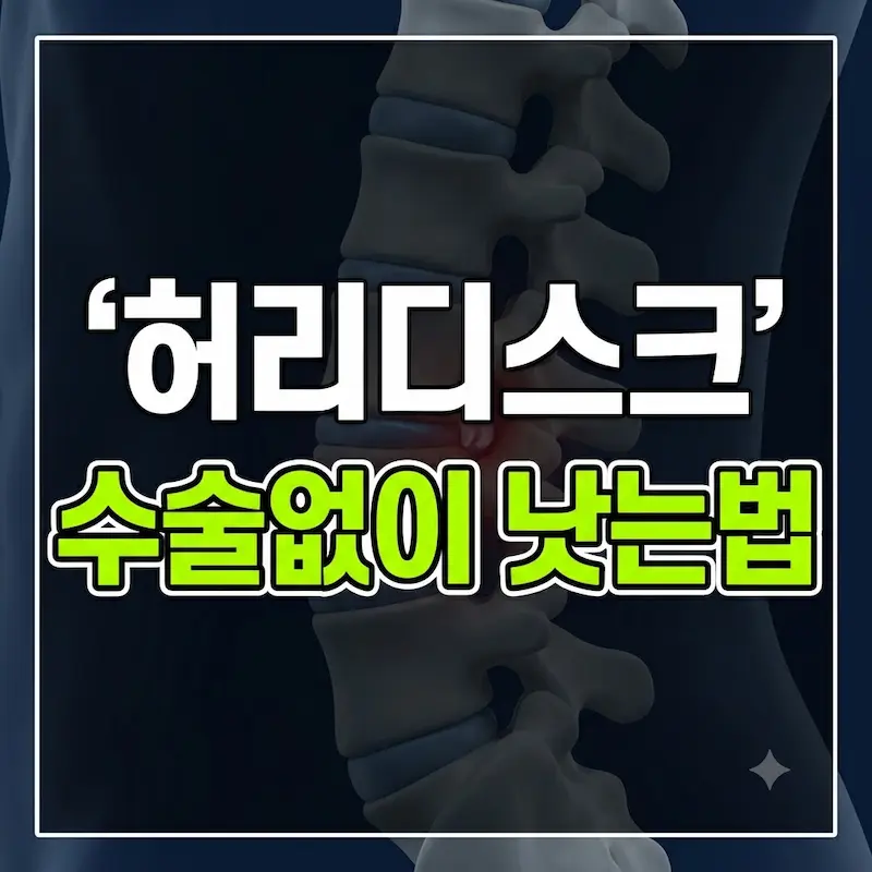 네이비 배경 척추 모형에 흰색과 형광 연두색 글자로 "허리디스크 수술없이 낫는법"이라고 쓰인 블로그 썸네일